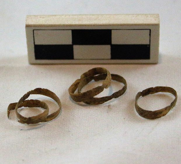 Artifact of the Month: Tracheal Rings